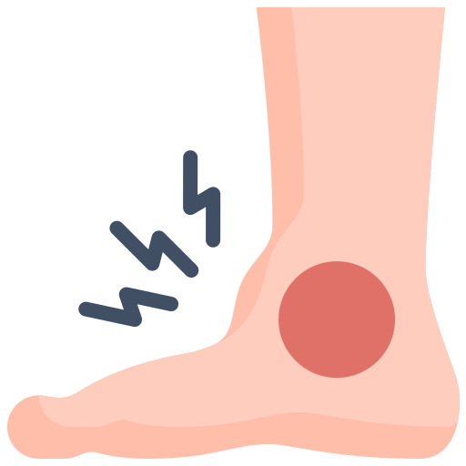 Ankle Sprain physiotherapy treatment in Pune